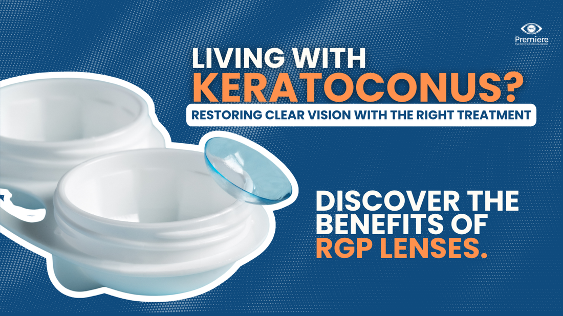 Keratoconus and RGP Lenses: Restoring Clear Vision with the Right Treatment